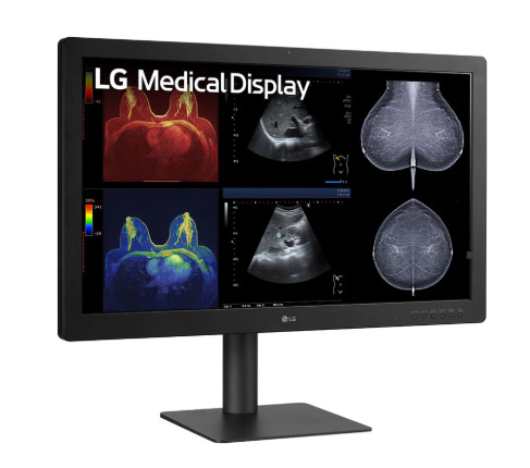 LG Diagnostic Display 21.3-inch (4:5) | IPS 5MP (2 048 x 2 560) MDRClass II - Afbeelding 4